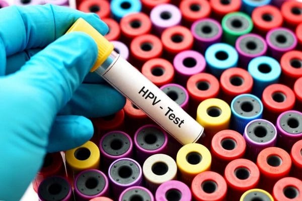 HPV: prevenção e sintomas do papilomavírus humano