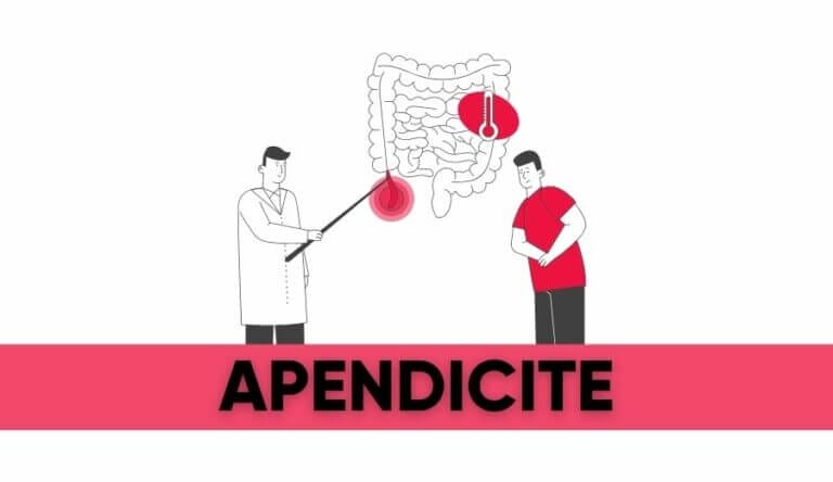 apendicite header