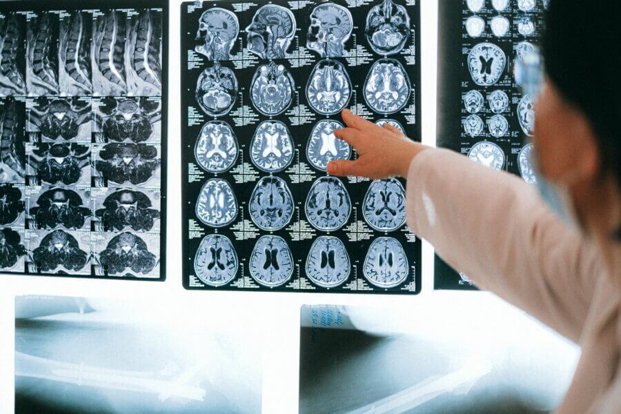 médicos analisando cérebro