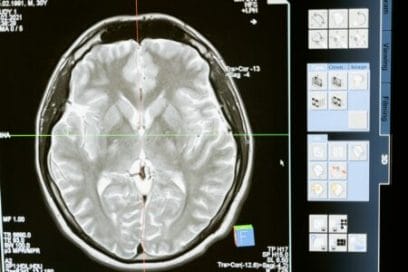exame de neurofeedback do cérebro 